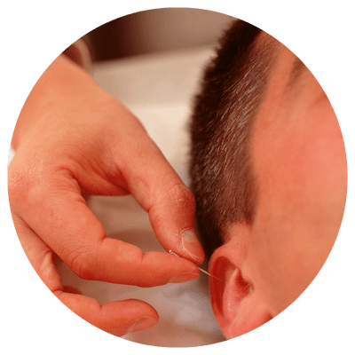 Reabilitação neurofuncional para adultos e criança domiciliar. Auriculoterapia francesa neuroafetiv.