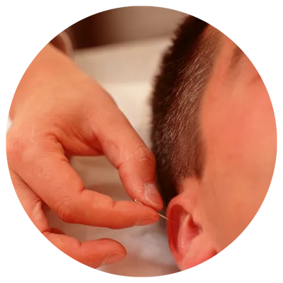 Reabilitação neurofuncional para adultos e criança domiciliar. Auriculoterapia francesa neuroafetiv.